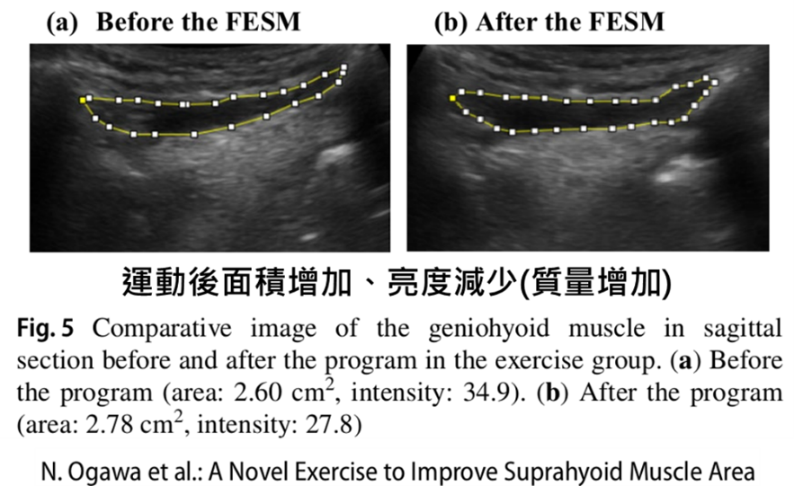 geniohyoid ultrasound